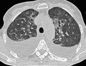 Why Are Failed CT Tests on Tour Hidden from the Public? What You Need to Know