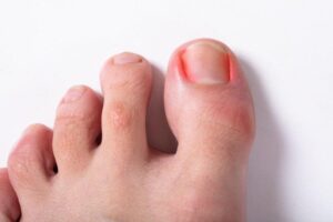 Master Your Moves: Harness the Power of Your Big Toe to Take Control